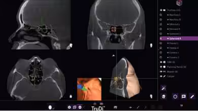 Interface de l'outil TruDi montrant des scans médicaux en tomodensitométrie avec annotations.