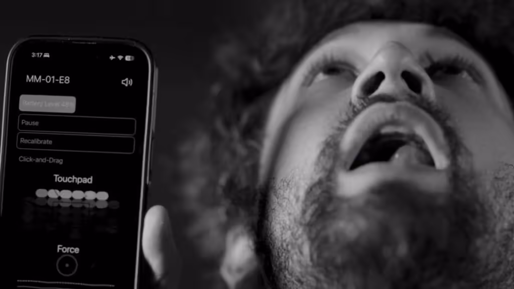 MouthPad : ce pavé tactile qui se contrôle avec la langue est désormais disponible 3 MouthPad 1